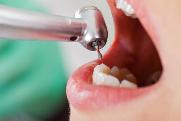 Best Cracked Tooth Emergency Dentist  in Carmel, IN
